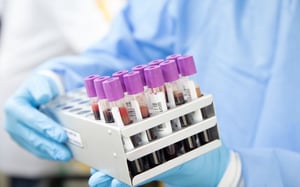 Lab Samples